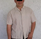  Bandingkan Sebelum & Sesudah Foto Operasi Bypass Lambung