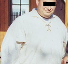  Bandingkan Sebelum & Sesudah Foto Operasi Bypass Lambung