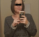  Bandingkan Sebelum & Sesudah Foto Operasi Bypass Lambung