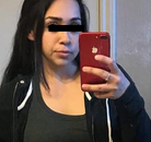  Bandingkan Sebelum & Sesudah Foto Operasi Bypass Lambung