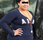  Bandingkan Sebelum & Sesudah Foto Operasi Bypass Lambung