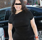 Bandingkan Sebelum & Sesudah Foto Operasi Ikat Lambung