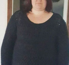 Bandingkan Sebelum & Sesudah Foto Operasi Ikat Lambung