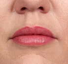  Bandingkan Sebelum & Sesudah Foto Augmentasi Bibir