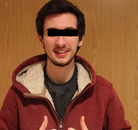  Bandingkan Sebelum & Sesudah Foto Operasi Penggantian Kelamin (Perempuan ke Laki-Laki)