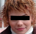  Bandingkan Sebelum & Sesudah Foto Operasi Penggantian Kelamin (Perempuan ke Laki-Laki)