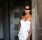  Bandingkan Sebelum & Sesudah Foto Operasi Penggantian Kelamin (Perempuan ke Laki-Laki)