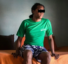  Bandingkan Sebelum & Sesudah Foto Operasi Penggantian Kelamin (Perempuan ke Laki-Laki)