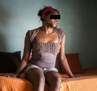  Bandingkan Sebelum & Sesudah Foto Operasi Penggantian Kelamin (Perempuan ke Laki-Laki)