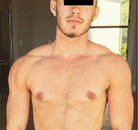  Bandingkan Sebelum & Sesudah Foto Operasi Penggantian Kelamin (Perempuan ke Laki-Laki)