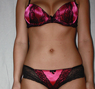 Bandingkan Sebelum & Sesudah Foto Vaser-Liposuction