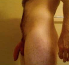  Bandingkan Sebelum & Sesudah Foto Augmentasi Penis