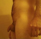  Bandingkan Sebelum & Sesudah Foto Augmentasi Penis