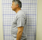  Bandingkan Sebelum & Sesudah Foto Penyesuaian Chiropractic