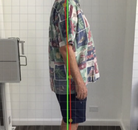  Bandingkan Sebelum & Sesudah Foto Penyesuaian Chiropractic