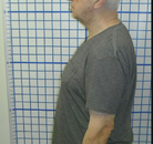  Bandingkan Sebelum & Sesudah Foto Penyesuaian Chiropractic