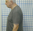  Bandingkan Sebelum & Sesudah Foto Penyesuaian Chiropractic