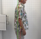  Bandingkan Sebelum & Sesudah Foto Pengobatan Chiropractic