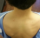  Bandingkan Sebelum & Sesudah Foto Pengobatan Chiropractic