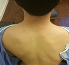  Bandingkan Sebelum & Sesudah Foto Pengobatan Chiropractic