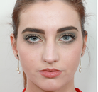  Bandingkan Sebelum & Sesudah Foto Rinoplasti