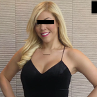 Compare Before & After Photos of _procedure_photos.phpGastric Sleeve