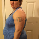 Compare Before & After Photos of _procedure_photos.phpGastric Sleeve