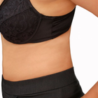 Compare Before & After Photos of _procedure_photos.phpGastric Sleeve