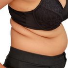 Compare Before & After Photos of _procedure_photos.phpGastric Sleeve