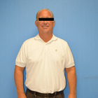 Compare Before & After Photos of _procedure_photos.phpGastric Sleeve