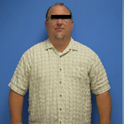 Compare Before & After Photos of _procedure_photos.phpGastric Sleeve