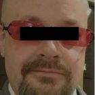 Compare Before & After Photos of _procedure_photos.phpSex Reassignment Surgery (Male to Female)