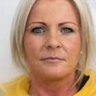 Compare Before & After Photos of _procedure_photos.phpFacelift