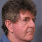 Compare Before & After Photos of _procedure_photos.phpFacelift