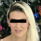 Compare Before & After Photos of _procedure_photos.phpFacial Feminization Surgery (FFS)