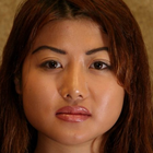 Compare Before & After Photos of _procedure_photos.phpDouble Eyelid Creation