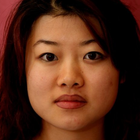 Compare Before & After Photos of _procedure_photos.phpDouble Eyelid Creation