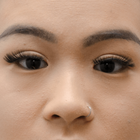 Compare Before & After Photos of _procedure_photos.phpDouble Eyelid Creation