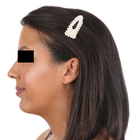 Compare Before & After Photos of _procedure_photos.phpHairline Lowering Surgery