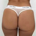 Compare Before & After Photos of _procedure_photos.phpButt Lift