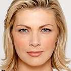 Compare Before & After Photos of _procedure_photos.phpBotox Injections