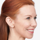 Compare Before & After Photos of _procedure_photos.phpBotox Injections