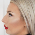 Compare Before & After Photos of _procedure_photos.phpBotox Injections