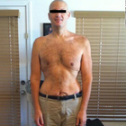 Compare Before & After Photos of _procedure_photos.phpGastric Bypass Surgery