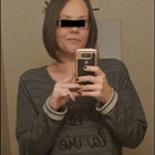 Compare Before & After Photos of _procedure_photos.phpGastric Bypass Surgery