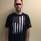 Compare Before & After Photos of _procedure_photos.phpGastric Bypass Surgery