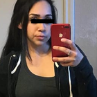 Compare Before & After Photos of _procedure_photos.phpGastric Bypass Surgery