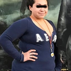 Compare Before & After Photos of _procedure_photos.phpGastric Bypass Surgery