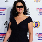 Compare Before & After Photos of _procedure_photos.phpGastric Band Surgery