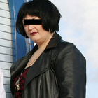 Compare Before & After Photos of _procedure_photos.phpGastric Band Surgery